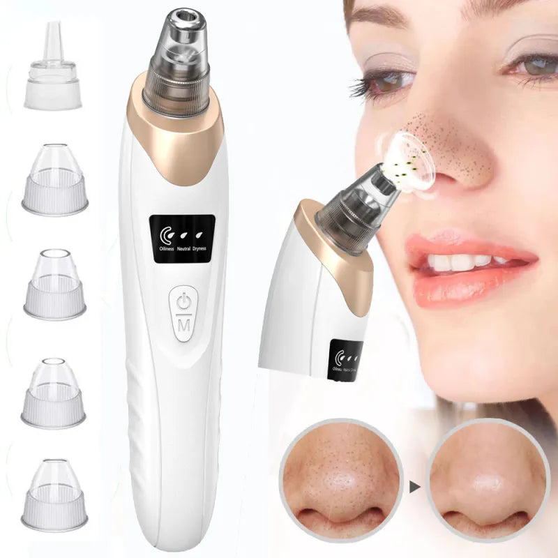 lusailstore - Electric Blackhead Remover