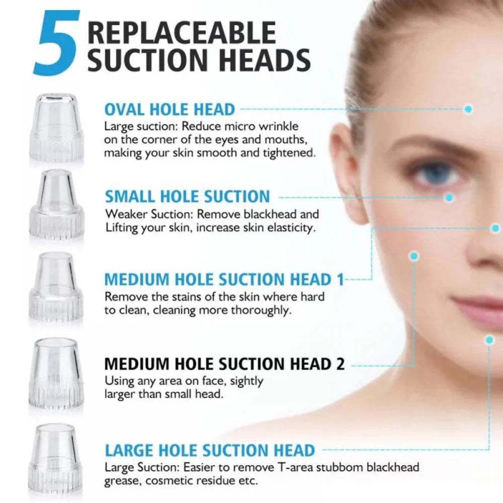 lusailstore - Electric Blackhead Remover