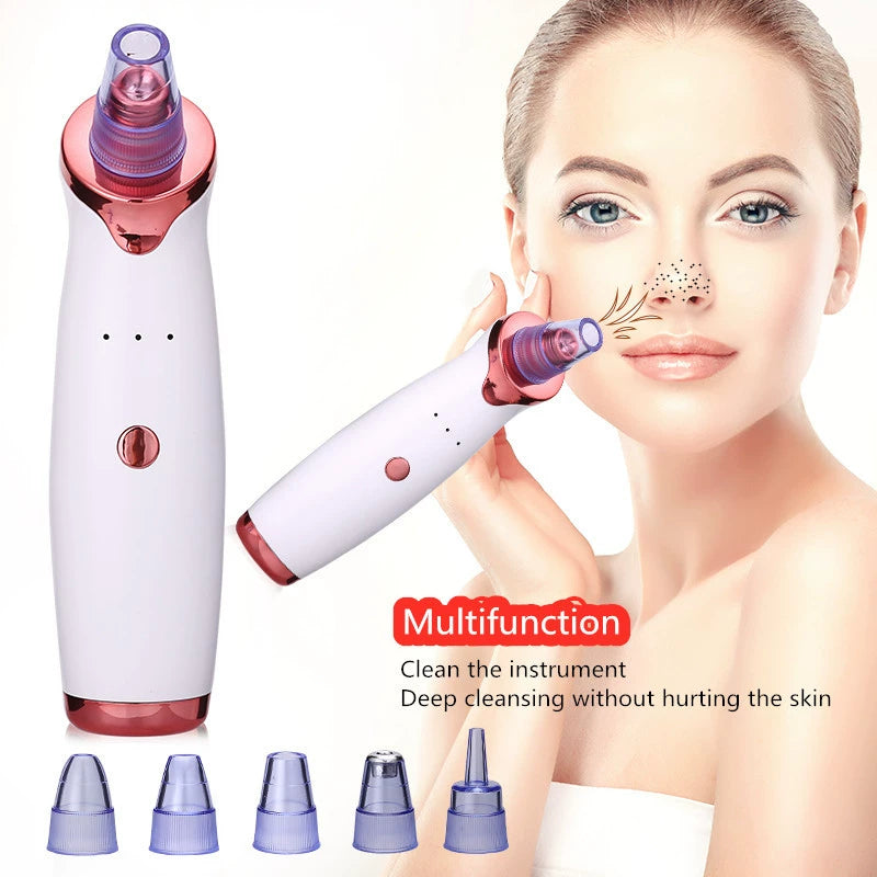 lusailstore - Electric Blackhead Remover