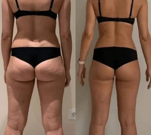 lusailstore - EMS buttocks trainer