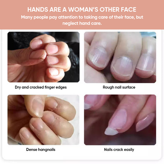 lusailstore - Nails Nutritious Growth Oil