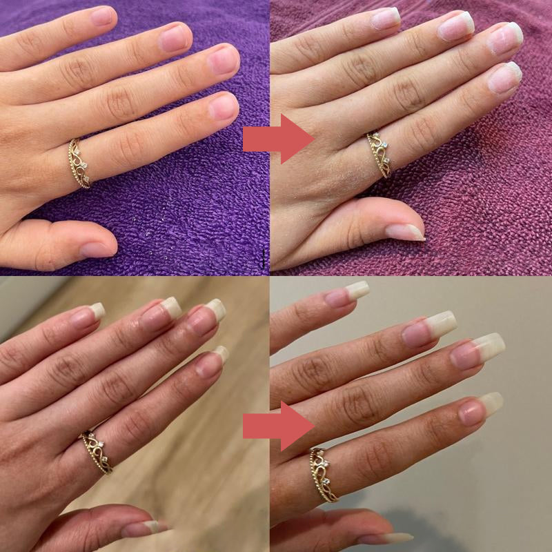 lusailstore - Nails Nutritious Growth Oil