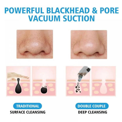 lusailstore - Electric Blackhead Remover