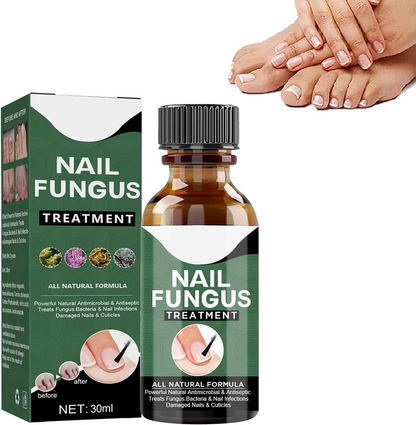 lusailstore - Nail Fungus Repair Serum