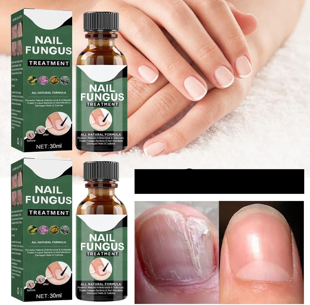 lusailstore - Nail Fungus Repair Serum
