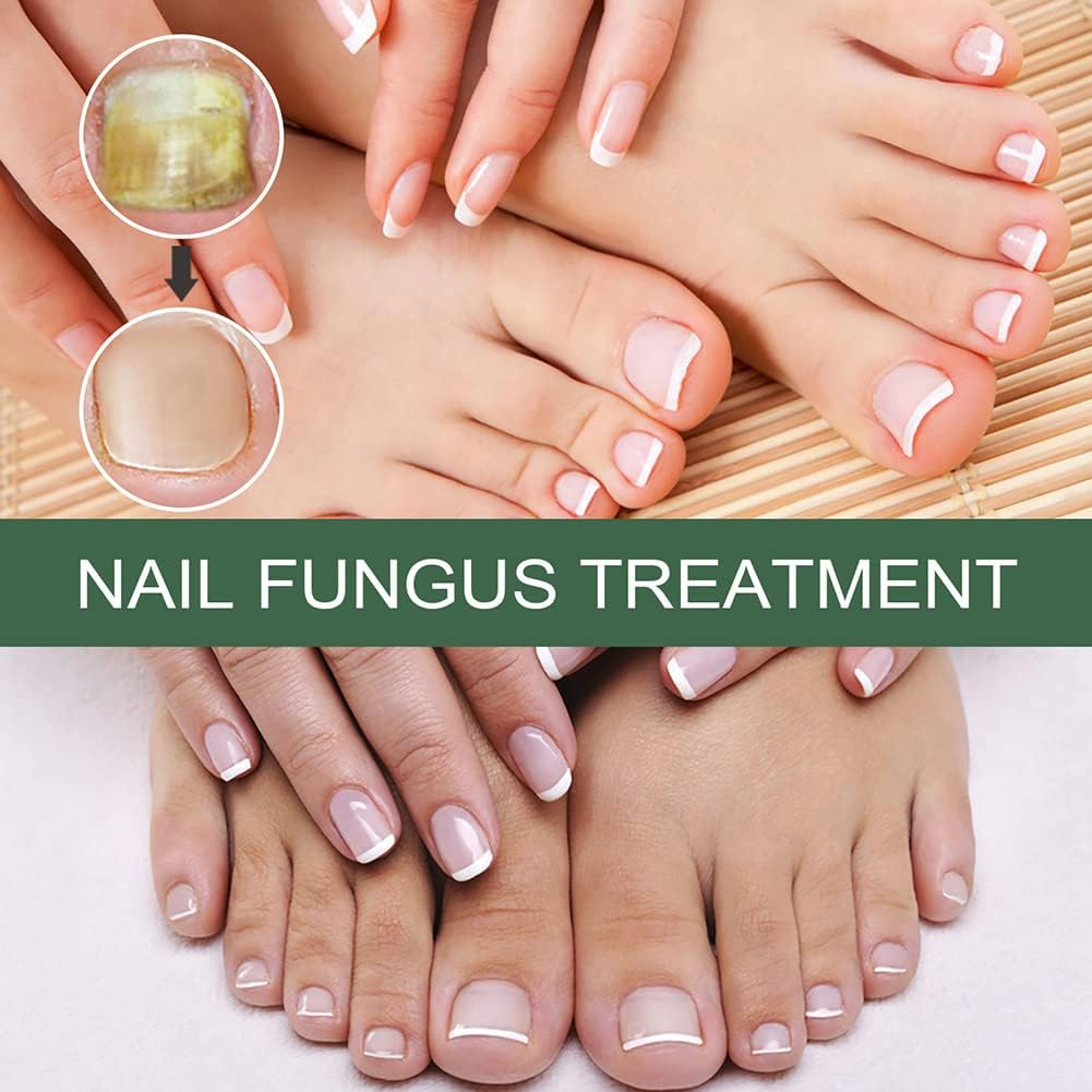 lusailstore - Nail Fungus Repair Serum