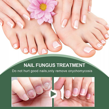 lusailstore - Nail Fungus Repair Serum