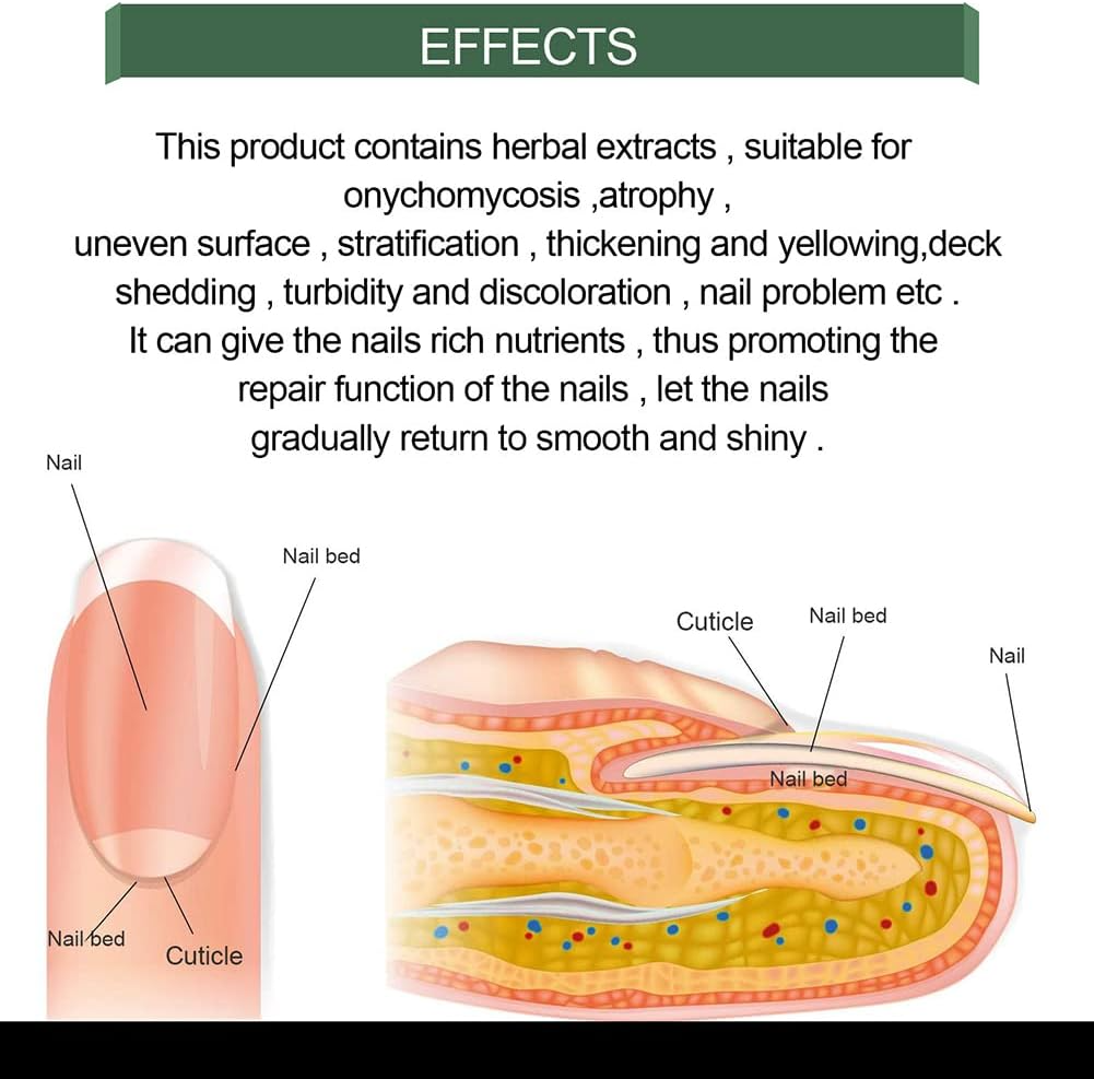 lusailstore - Nail Fungus Repair Serum