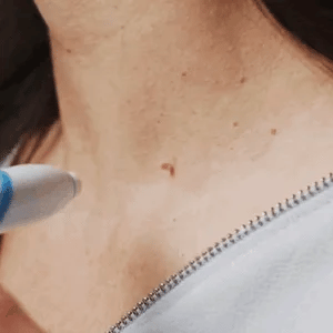 lusailstore - fast auto tag removal kit
